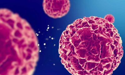 Anti-tumorwerking van CBD