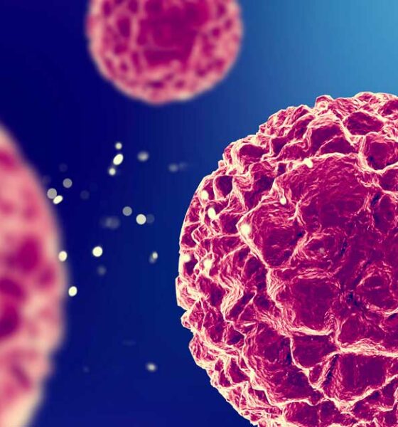 Anti-tumorwerking van CBD