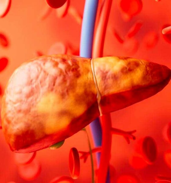 Leversteatose en cannabinoïden