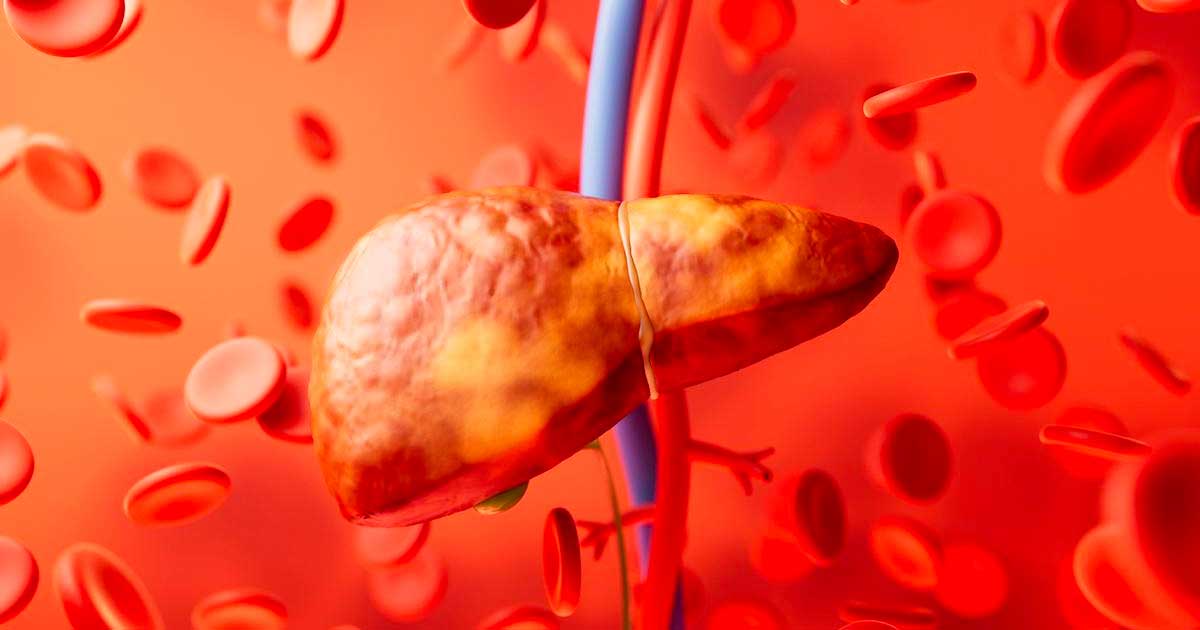 Leversteatose en cannabinoïden