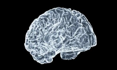 CBN en de ziekte van Alzheimer