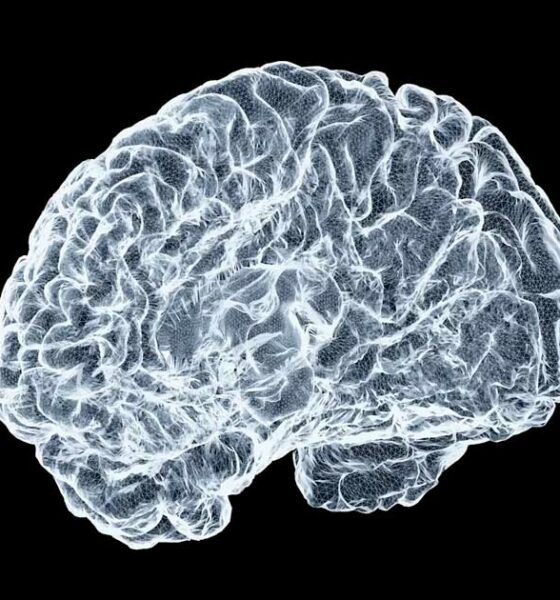 CBN en de ziekte van Alzheimer